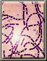 Graphic of bacillus